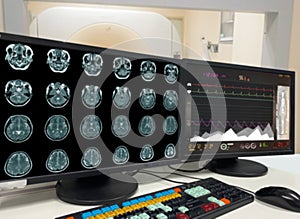 Blur Medical CT or MRI or PET Brain Scan film on a computer monitor. Technologically advanced and functional medical office
