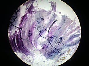 Motor nerve endings