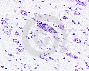 Motor neuron. Nissl bodies