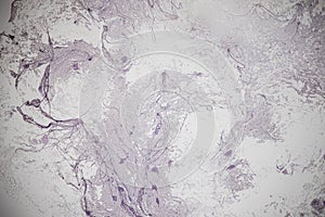 Motor Neuron, Spinal cord, Nerve fibres and nerve cells under the microscope.