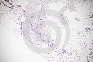 Motor Neuron, Spinal cord, Nerve fibres and nerve cells under the microscope.