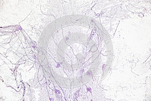 Motor Neuron, Spinal cord, Nerve fibres and nerve cells under the microscope.