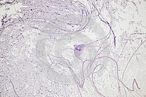 Motor Neuron, Spinal cord, Nerve fibres and nerve cells under the microscope.