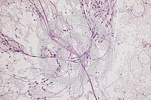 Motor Neuron, Spinal cord, Nerve fibres and nerve cells under the microscope.