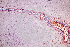 Motor Neuron, Spinal cord, Nerve fibres and nerve cells under the microscope.