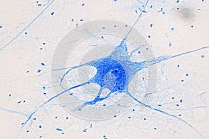 Motor Neuron under the microscope.