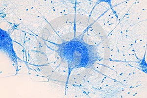 Motor Neuron under the microscope.