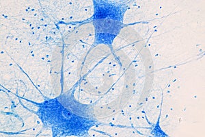 Motor Neuron under the microscope. photo