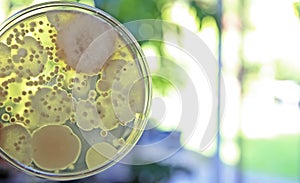 Mould test petri dish culture medium with spore colonies for measuring mold contamination in the air indoors