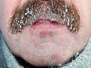 Moustaches with ice