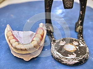 Mouth articulator and teeth. Dental technician