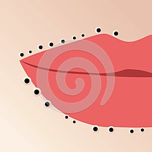Mouth with blackheads or black dots or acne pimples, illustration