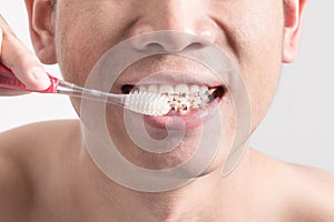 Mouth with braces while brushing