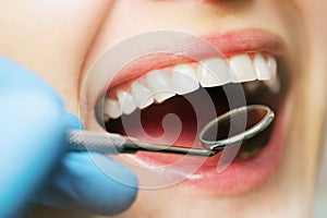 Mouth checkup oral hygiene. white healthy woman teeth and dentist mirror