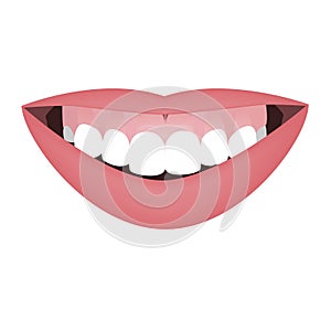 Mouth with a distal bite and high smile line or gummy smile before the orthotropics or orthotropics treatment. Vector photo