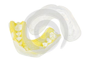 Mouth Guards