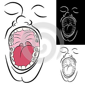 Mouth with Metal Dental Fillings