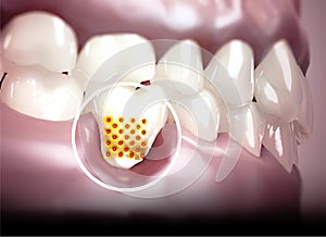 Mouth, teeth, gums. Sensitive teeth, withdrawal of the gingiva. Dental sensitivity.