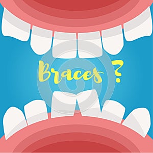 Mouth. View from the inside