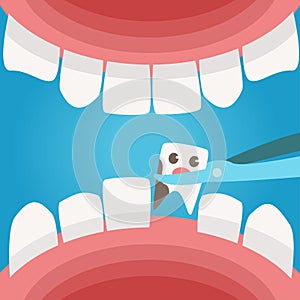 Mouth. View from the inside. Caries