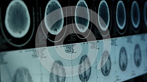 Moving head pet cT scan,skull brain X-ray.