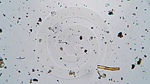 Moving a rotifer close up in fresh water under a microscope