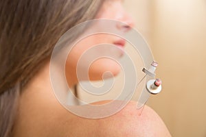 Moxibustion acupunture needles heat on woman