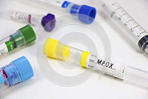Mpox blood test empty tubes samples on the white background, studio shoot photo