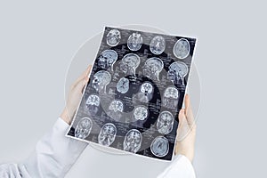 MRI of the brain. Neuropathologist holds a picture against the background of a light device to see pathologies and injuries brain.