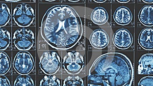 Mri brain scan background, magnetic resonance tomography