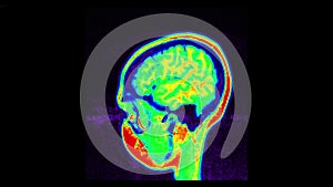 MRI brain scan, magnetic resonance image. CT scan of human brain in dynamic.