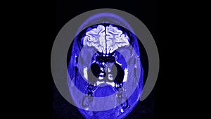 MRI brain scan, magnetic resonance image. CT scan of human brain in dynamic.