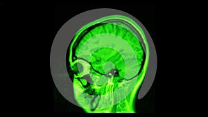 MRI brain scan, magnetic resonance image. CT scan of human brain in dynamic.