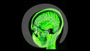 MRI brain scan, magnetic resonance image. CT scan of human brain in dynamic.