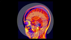 MRI brain scan, magnetic resonance image. CT scan of human brain in dynamic.