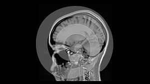 MRI brain scan, magnetic resonance image. CT scan of human brain in dynamic.