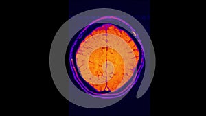 MRI brain scan, magnetic resonance image. CT scan of human brain in dynamic.