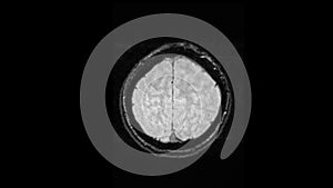 MRI brain scan, magnetic resonance image. CT scan of human brain in dynamic.