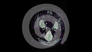 MRI brain scan, magnetic resonance image. CT scan of human brain in dynamic.