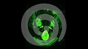 MRI brain scan, magnetic resonance image. CT scan of human brain in dynamic.