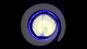 MRI brain scan, magnetic resonance image. CT scan of human brain in dynamic.