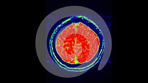 MRI brain scan, magnetic resonance image. CT scan of human brain in dynamic.