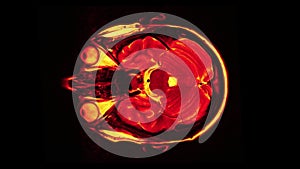 MRI brain scan, magnetic resonance image. CT scan of human brain in dynamic.