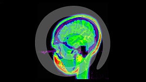 MRI brain scan, magnetic resonance image. CT scan of human brain in dynamic.