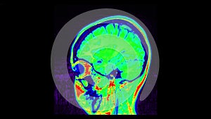 MRI brain scan, magnetic resonance image. CT scan of human brain in dynamic.