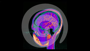 MRI brain scan, magnetic resonance image. CT scan of human brain in dynamic.