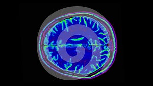 MRI brain scan, magnetic resonance image. CT scan of human brain in dynamic.