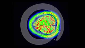 MRI brain scan, magnetic resonance image. CT scan of human brain in dynamic.