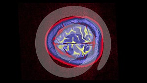 MRI brain scan, magnetic resonance image. CT scan of human brain in dynamic.