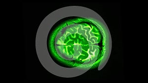 MRI brain scan, magnetic resonance image. CT scan of human brain in dynamic.